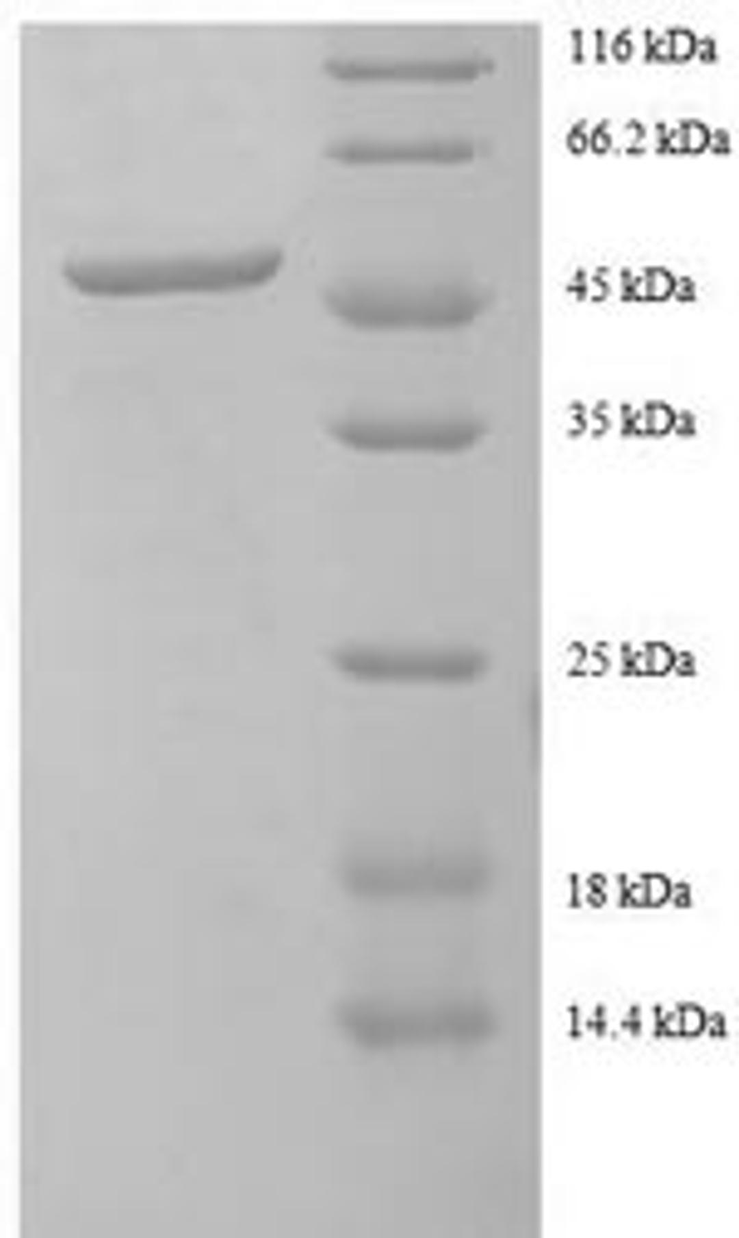 (Tris-Glycine gel) Discontinuous SDS-PAGE (reduced) with 5% enrichment gel and 15% separation gel.