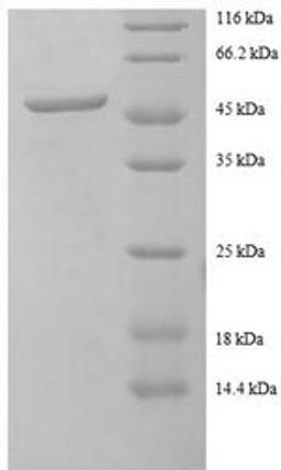 (Tris-Glycine gel) Discontinuous SDS-PAGE (reduced) with 5% enrichment gel and 15% separation gel.