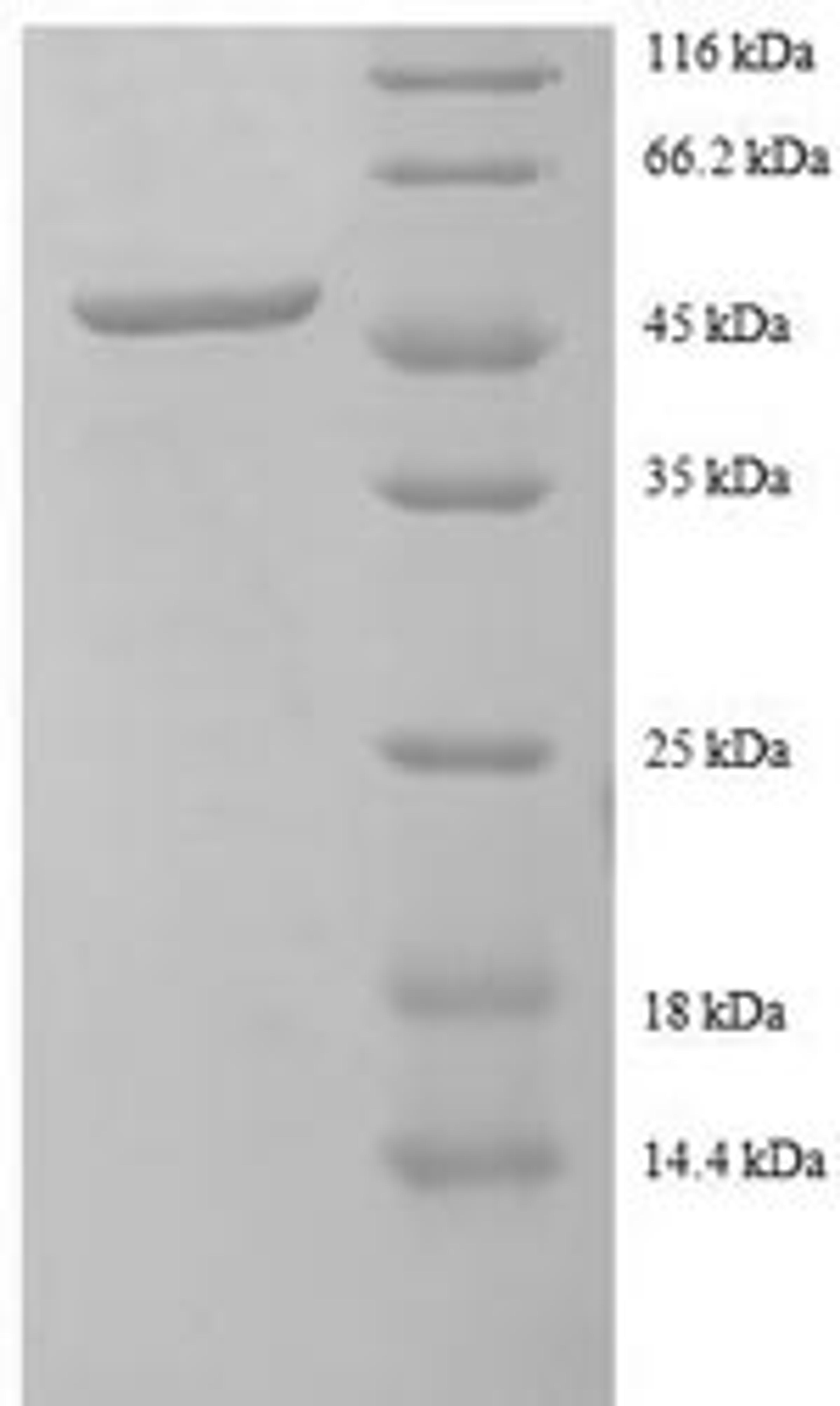 (Tris-Glycine gel) Discontinuous SDS-PAGE (reduced) with 5% enrichment gel and 15% separation gel.