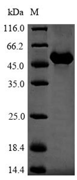 (Tris-Glycine gel) Discontinuous SDS-PAGE (reduced) with 5% enrichment gel and 15% separation gel.