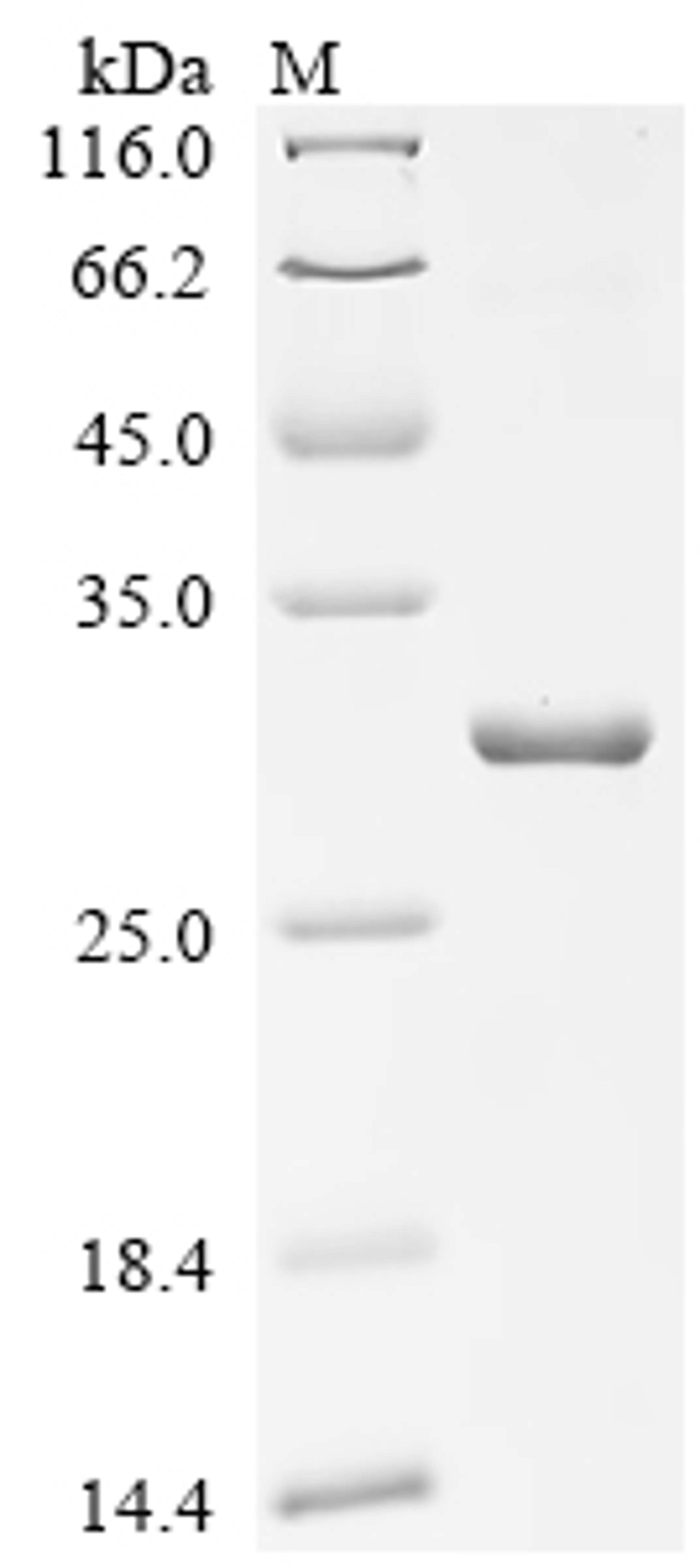 (Tris-Glycine gel) Discontinuous SDS-PAGE (reduced) with 5% enrichment gel and 15% separation gel.