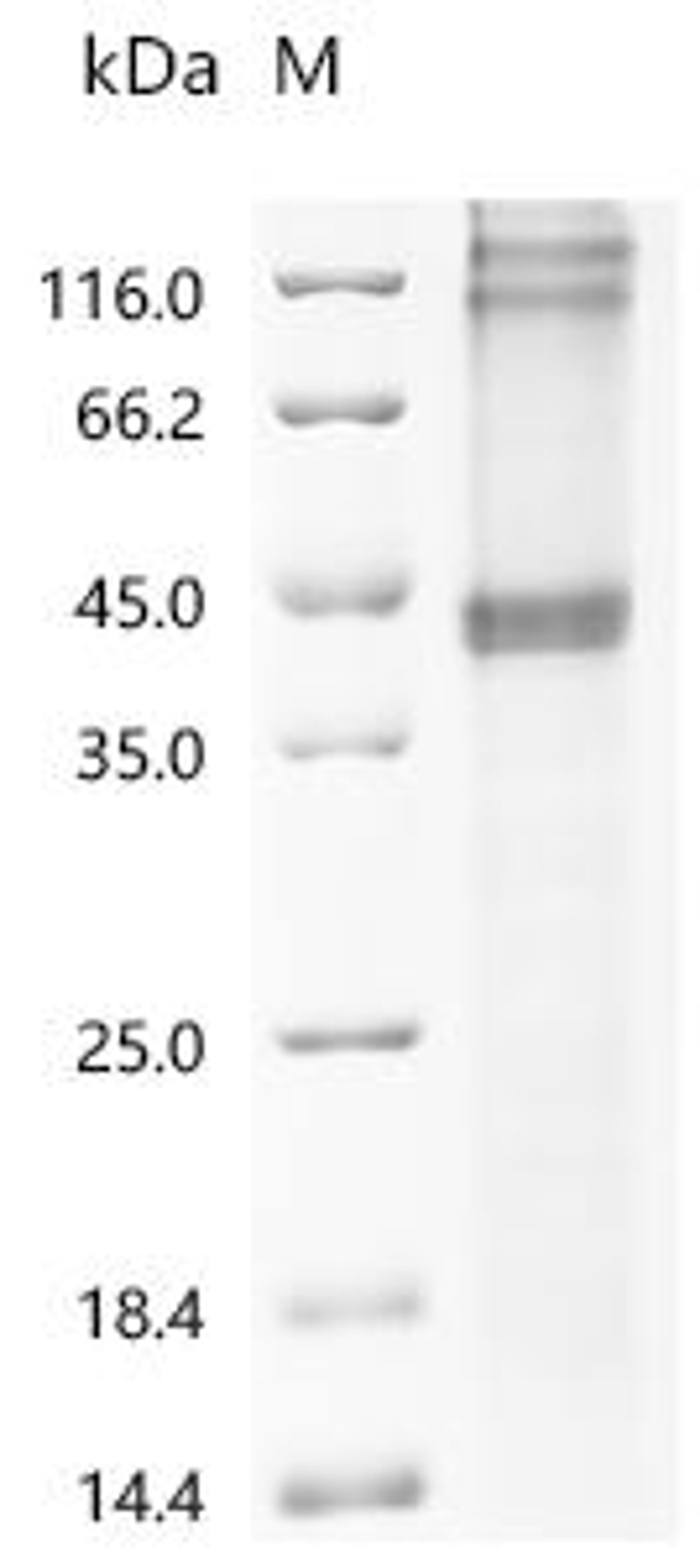 (Tris-Glycine gel) Discontinuous SDS-PAGE (reduced) with 5% enrichment gel and 15% separation gel.