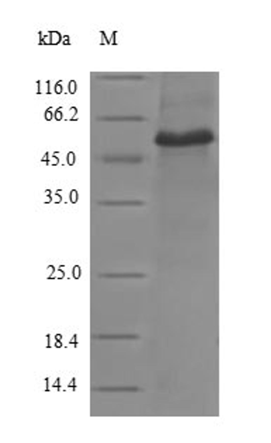 (Tris-Glycine gel) Discontinuous SDS-PAGE (reduced) with 5% enrichment gel and 15% separation gel.