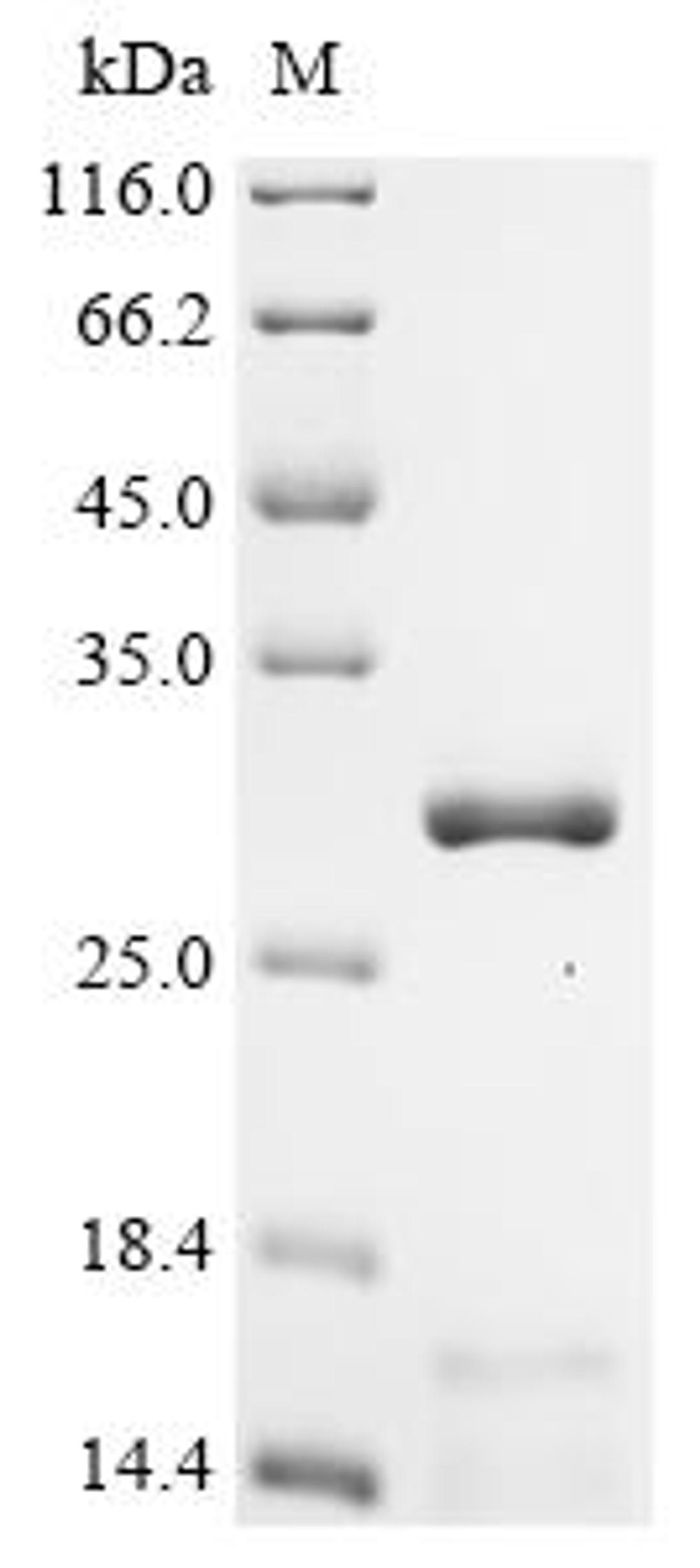 (Tris-Glycine gel) Discontinuous SDS-PAGE (reduced) with 5% enrichment gel and 15% separation gel.