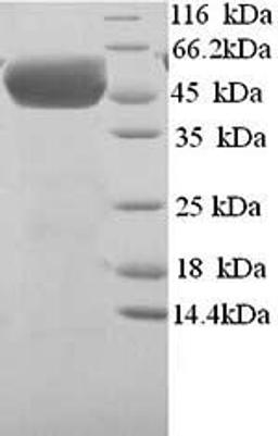 (Tris-Glycine gel) Discontinuous SDS-PAGE (reduced) with 5% enrichment gel and 15% separation gel.