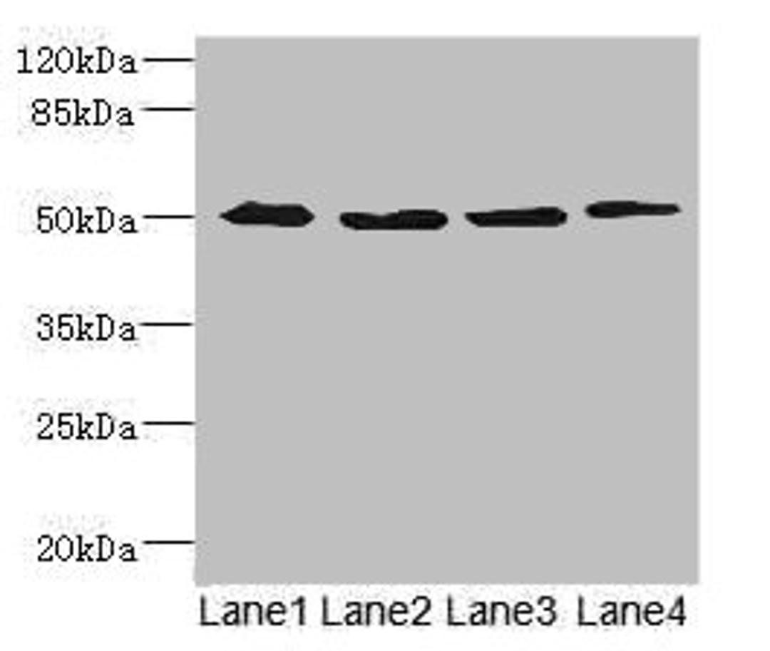 Western blot. All lanes: SQRDL antibody at 4.67ug/ml. Lane 1: A549 whole cell lysate. Lane 2: A431 whole cell lysate. Lane 3: Hela whole cell lysate. Lane 4: HepG2 whole cell lysate. Secondary. Goat polyclonal to rabbit IgG at 1/10000 dilution. Predicted band size: 50 kDa. Observed band size: 50 kDa. 