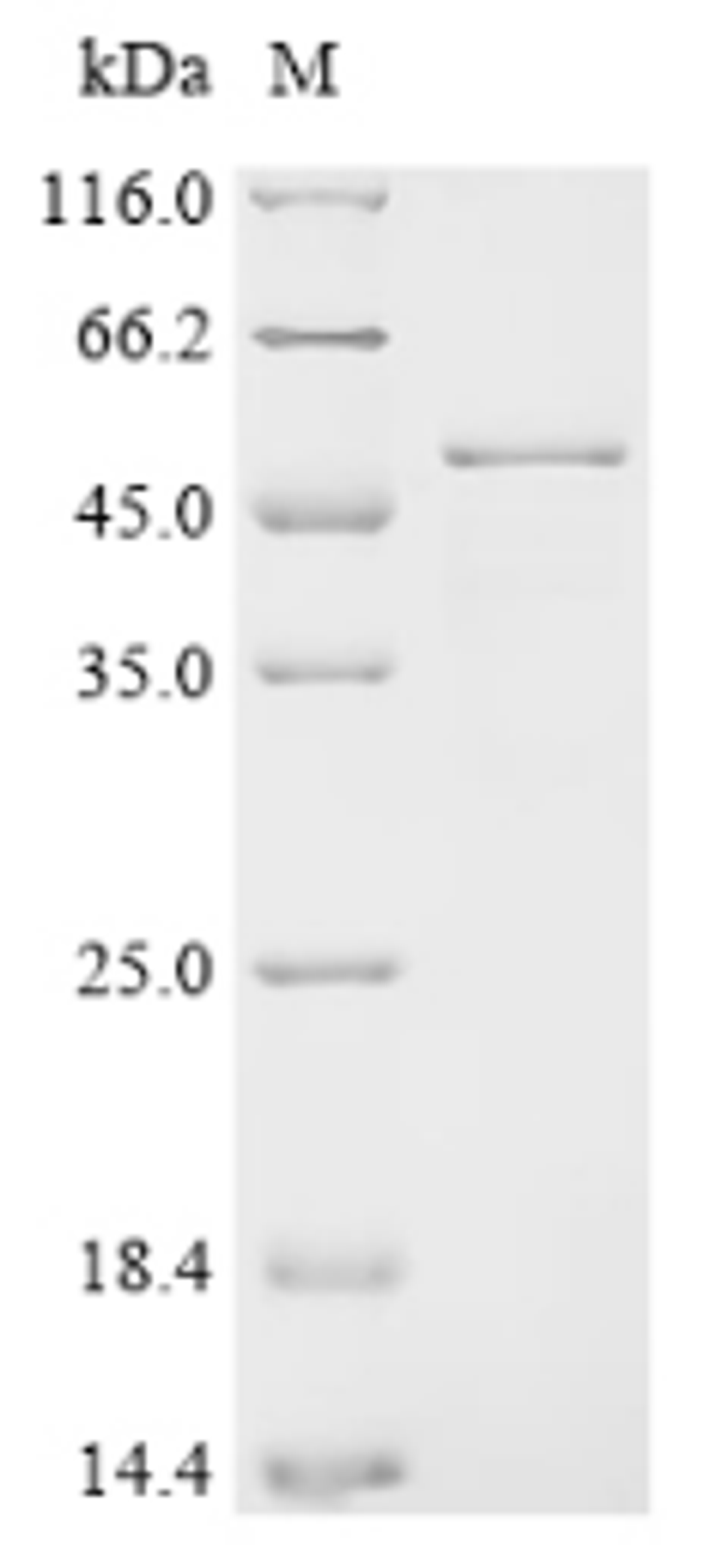 (Tris-Glycine gel) Discontinuous SDS-PAGE (reduced) with 5% enrichment gel and 15% separation gel.