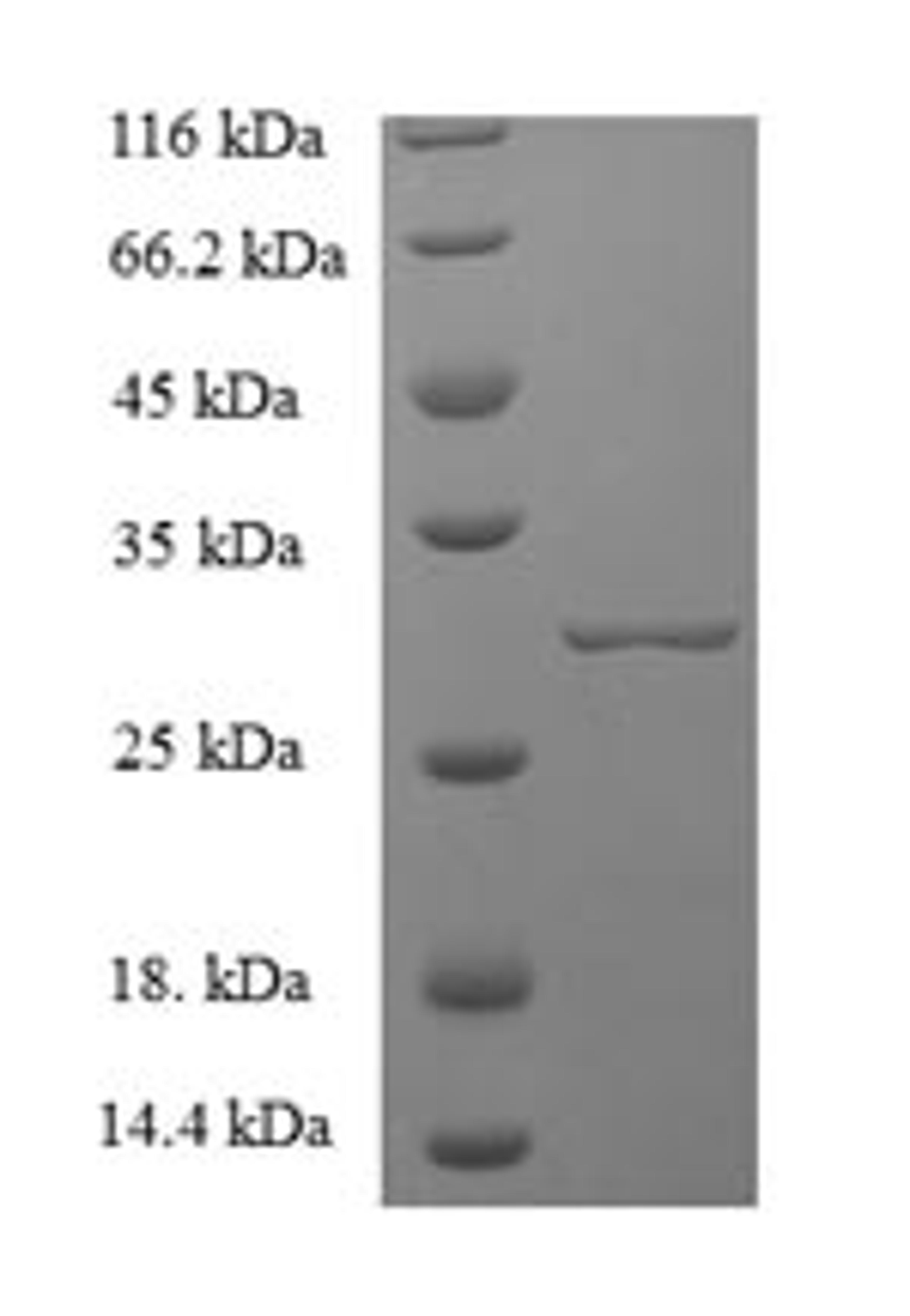 (Tris-Glycine gel) Discontinuous SDS-PAGE (reduced) with 5% enrichment gel and 15% separation gel.