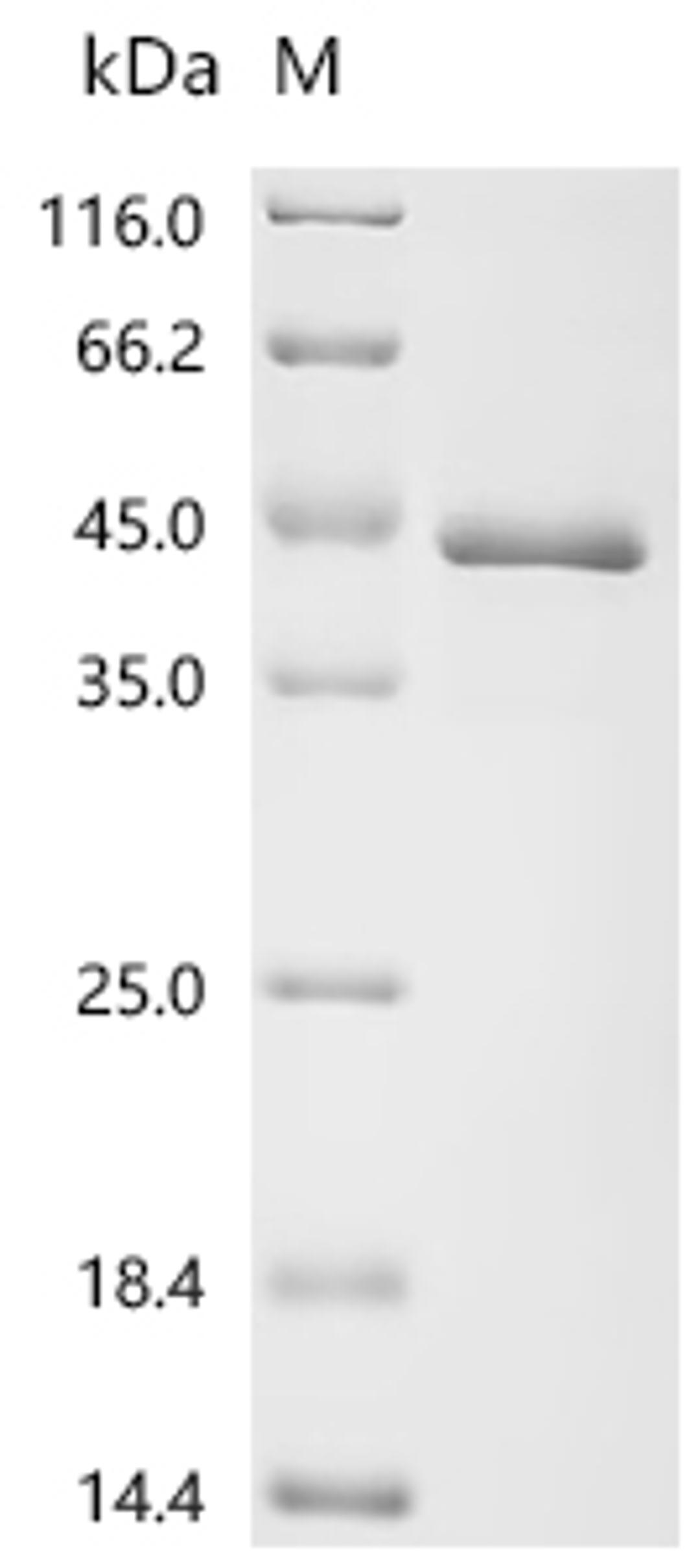 (Tris-Glycine gel) Discontinuous SDS-PAGE (reduced) with 5% enrichment gel and 15% separation gel.