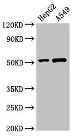 Western Blot. Positive WB detected in: HepG2 whole cell lysate, A549 whole cell lysate. All lanes: PNLIPRP2 antibody at 3µg/ml. Secondary. Goat polyclonal to rabbit IgG at 1/50000 dilution. Predicted band size: 52 kDa. Observed band size: 52 kDa