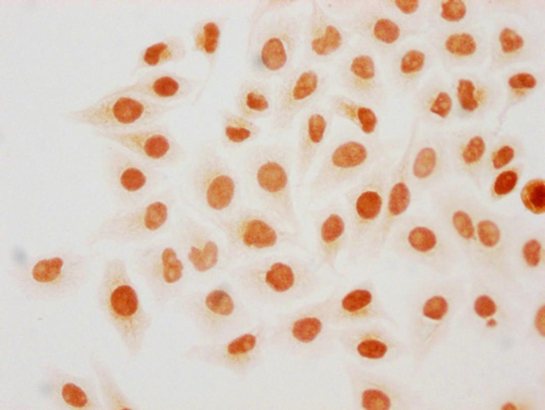 Immunocytochemistry analysis of CSB-PA010418PA18forHU diluted at 1:20 and staining in Hela cells(treated with 30mM sodium butyrate for 4h) performed on a Leica BondTM system. The cells were fixed in 4% formaldehyde, permeabilized using 0.2% Triton X-100 and blocked with 10% normal goat serum 30min at RT. Then primary antibody (1% BSA) was incubated at 4°C overnight. The primary is detected by a biotinylated secondary antibody and visualized using an HRP conjugated SP system.