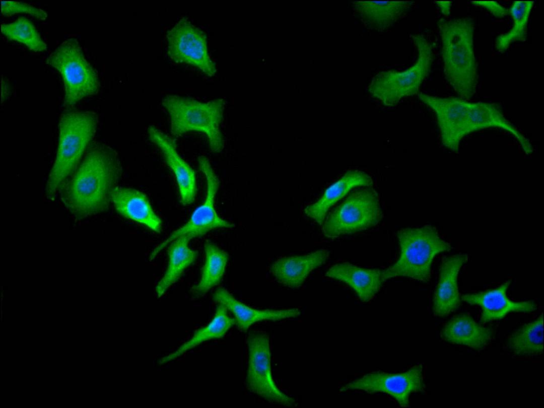 Immunofluorescence staining of Hela cell with CSB-RA001950MA3HU at 1:30, counter-stained with DAPI. The cells were fixed in 4% formaldehyde and blocked in 10% normal Goat Serum. The cells were then incubated with the antibody overnight at 4C. The secondary antibody was FITC-conjugated AffiniPure Goat Anti-Human IgG(H+L).