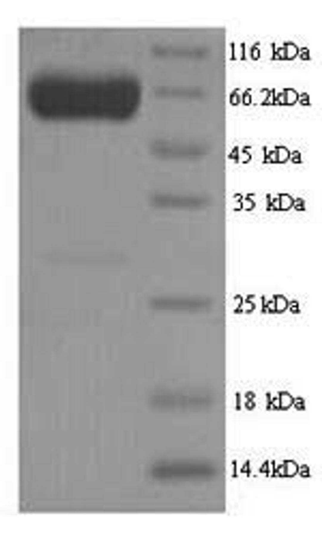 (Tris-Glycine gel) Discontinuous SDS-PAGE (reduced) with 5% enrichment gel and 15% separation gel.