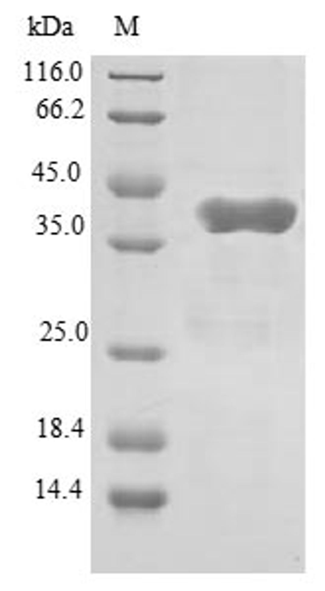 (Tris-Glycine gel) Discontinuous SDS-PAGE (reduced) with 5% enrichment gel and 15% separation gel.