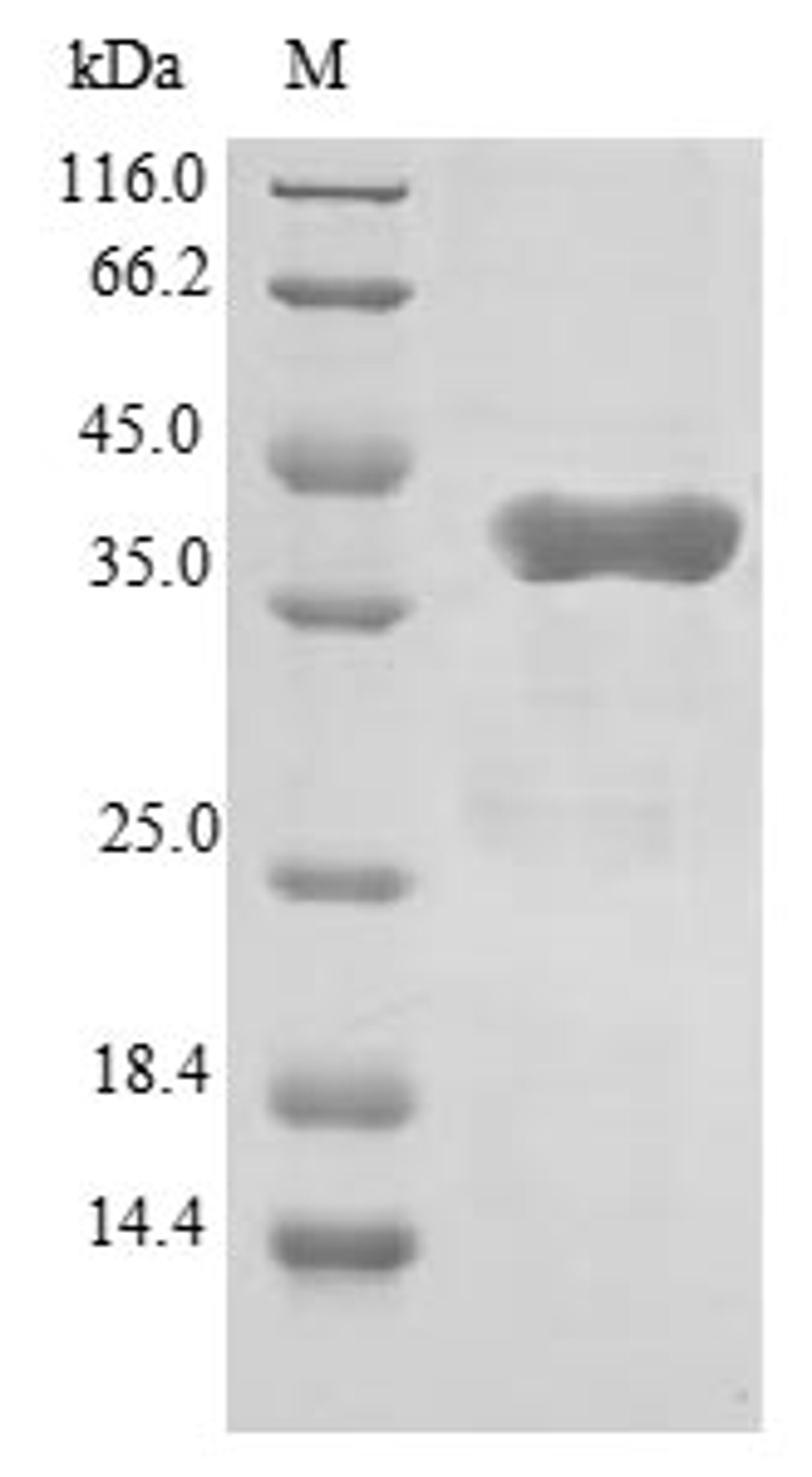 (Tris-Glycine gel) Discontinuous SDS-PAGE (reduced) with 5% enrichment gel and 15% separation gel.