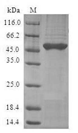 (Tris-Glycine gel) Discontinuous SDS-PAGE (reduced) with 5% enrichment gel and 15% separation gel.