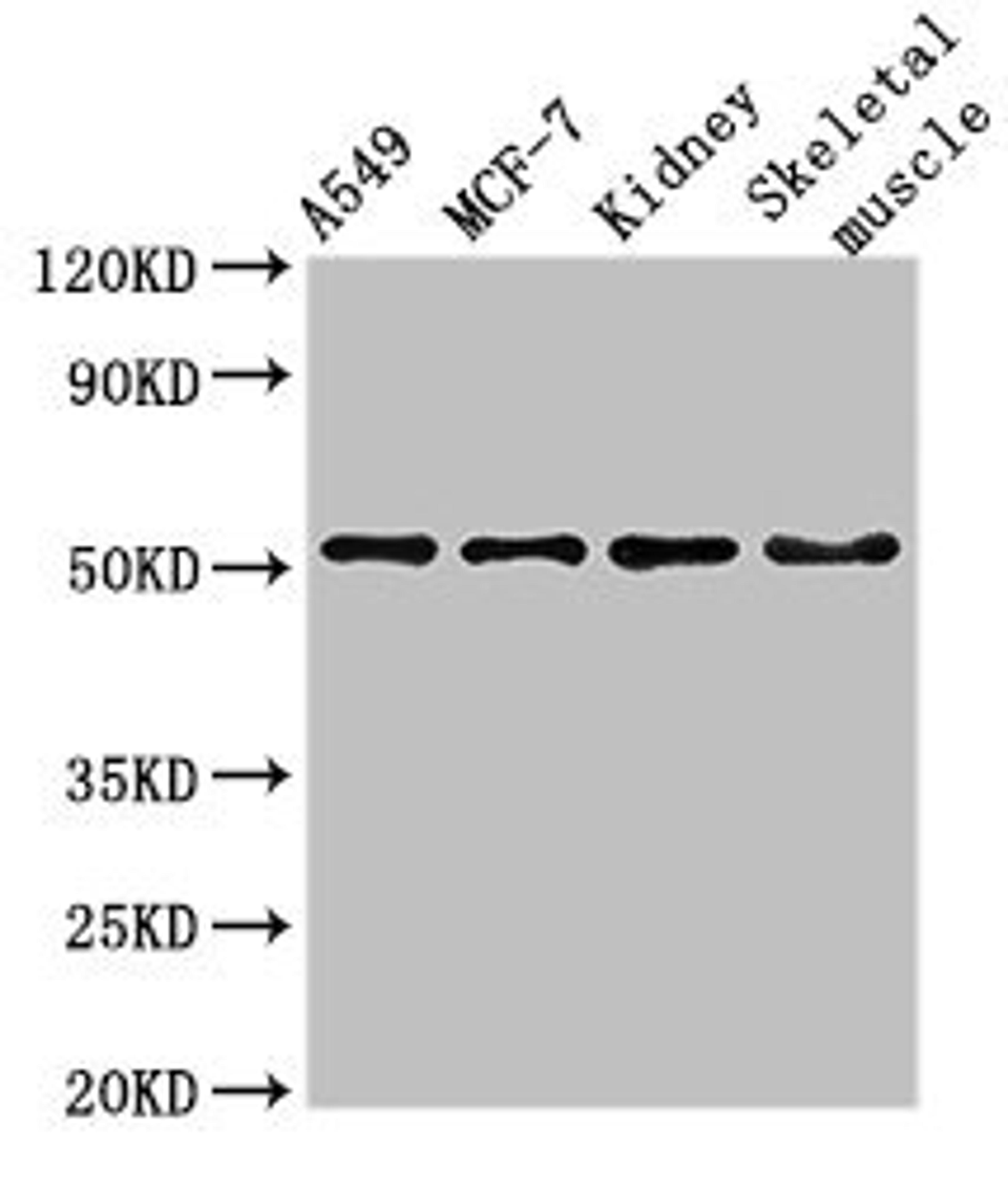 Western Blot. Positive WB detected in: A549 whole cell lysate, MCF-7 whole cell lysate, Mouse kidney tissue, Mouse skeletal muscle tissue. All lanes: NARF antibody at 3ug/ml. Secondary. Goat polyclonal to rabbit IgG at 1/50000 dilution. Predicted band size: 52, 57, 46, 45 kDa. Observed band size: 52 kDa. 
