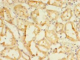 Immunohistochemistry of paraffin-embedded human kidney tissue using CSB-PA855490LA01HU at dilution of 1:100