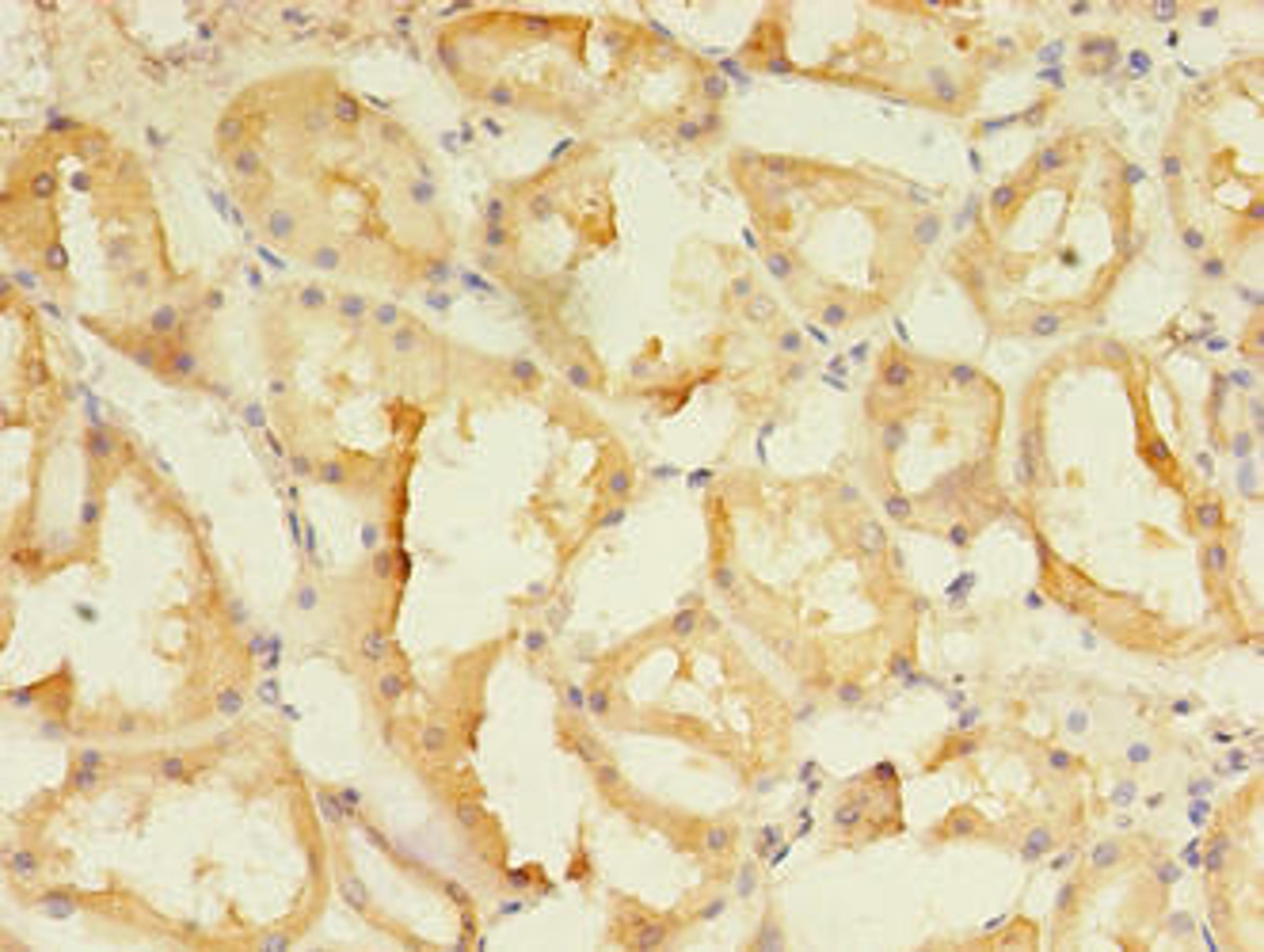 Immunohistochemistry of paraffin-embedded human kidney tissue using CSB-PA855490LA01HU at dilution of 1:100
