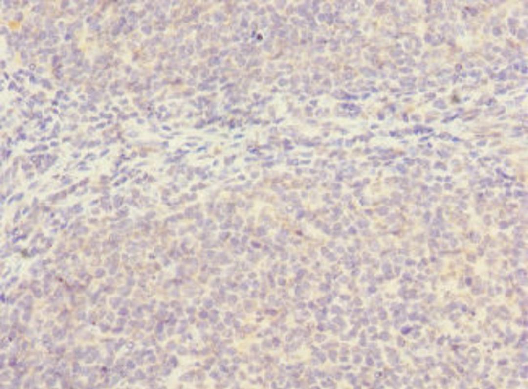 Immunohistochemistry of paraffin-embedded human tonsil tissue using CSB-PA021419LA01HU at dilution of 1:100