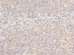 Immunohistochemistry of paraffin-embedded human tonsil tissue using CSB-PA021419LA01HU at dilution of 1:100
