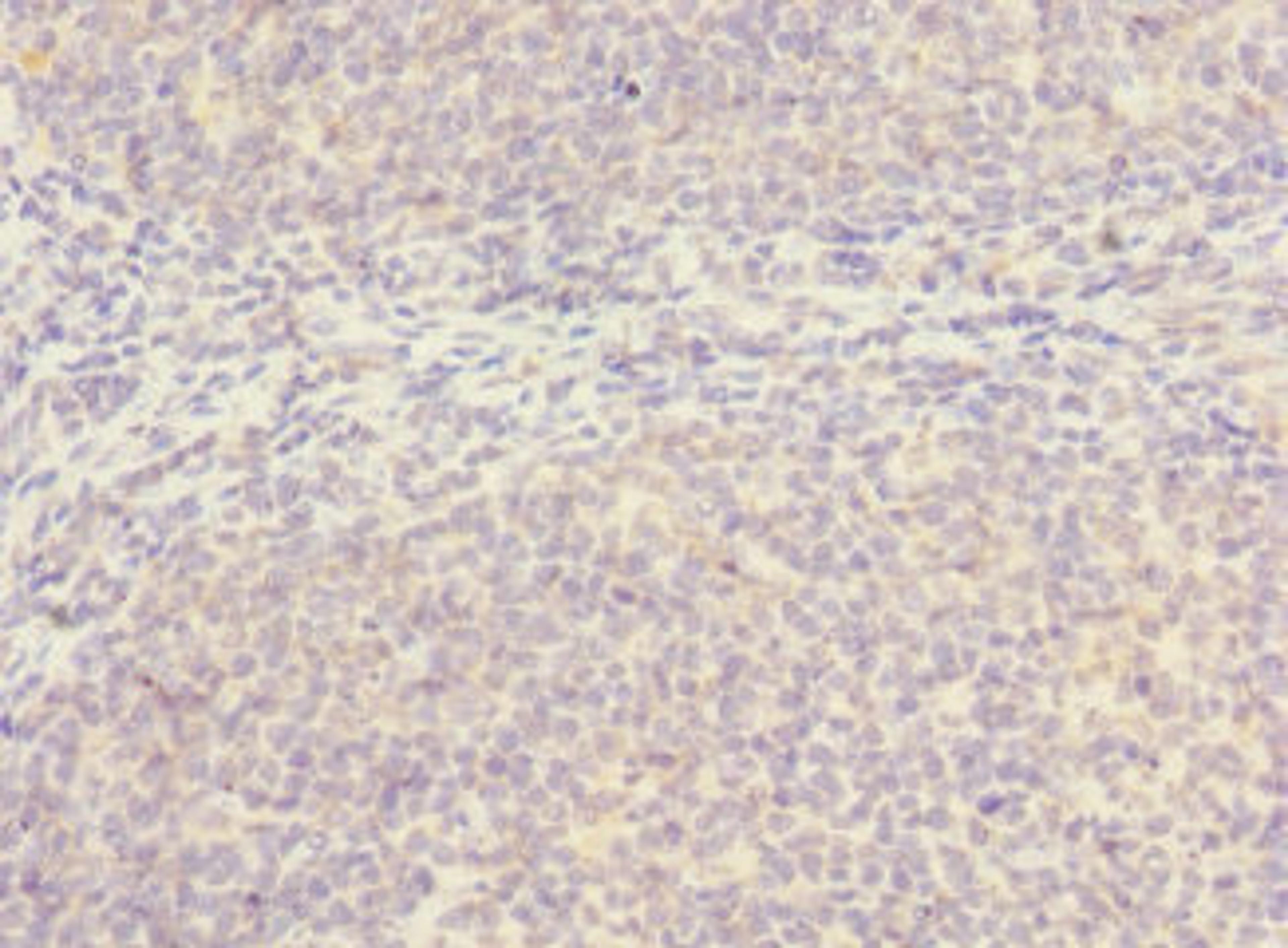 Immunohistochemistry of paraffin-embedded human tonsil tissue using CSB-PA021419LA01HU at dilution of 1:100