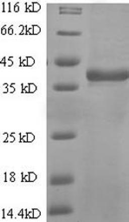 (Tris-Glycine gel) Discontinuous SDS-PAGE (reduced) with 5% enrichment gel and 15% separation gel.