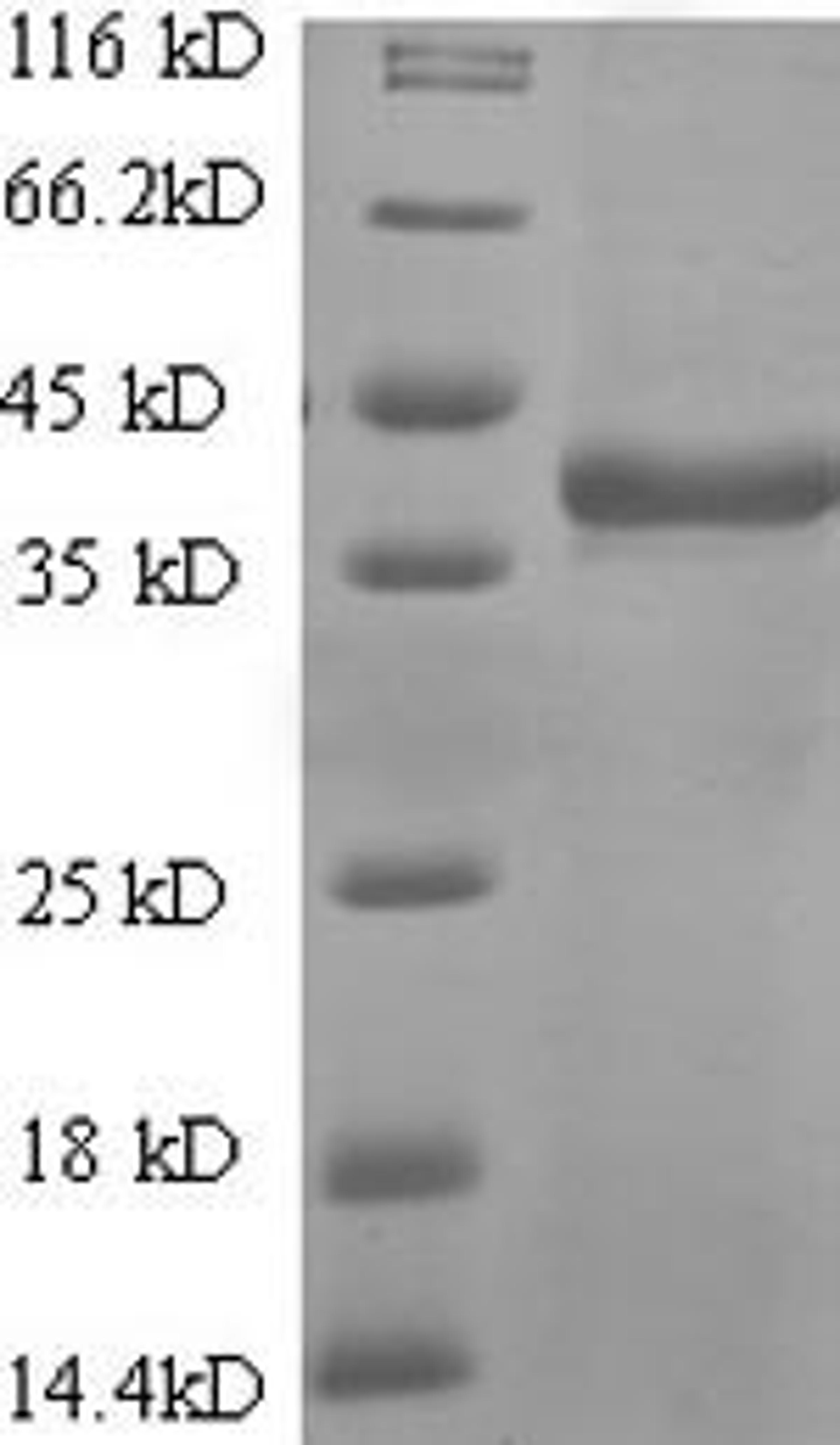 (Tris-Glycine gel) Discontinuous SDS-PAGE (reduced) with 5% enrichment gel and 15% separation gel.