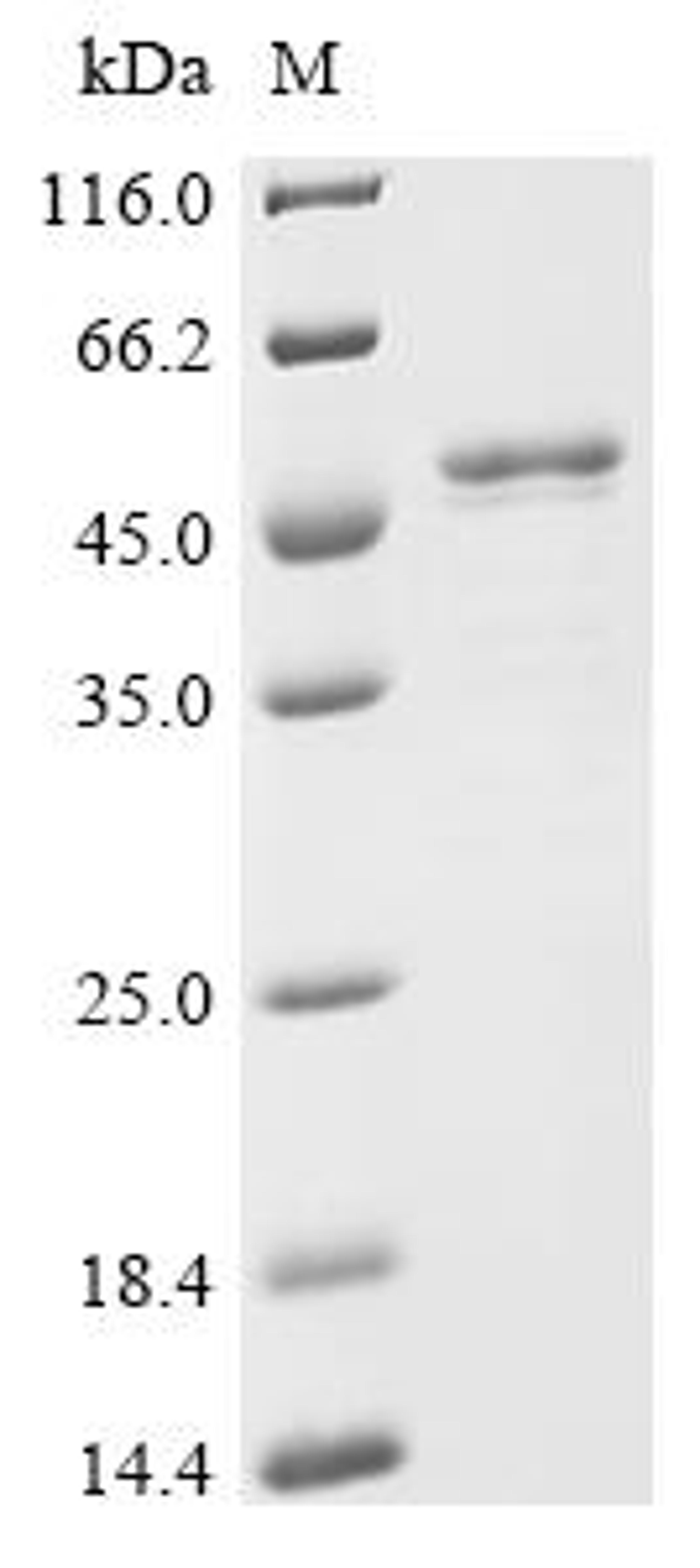 (Tris-Glycine gel) Discontinuous SDS-PAGE (reduced) with 5% enrichment gel and 15% separation gel.