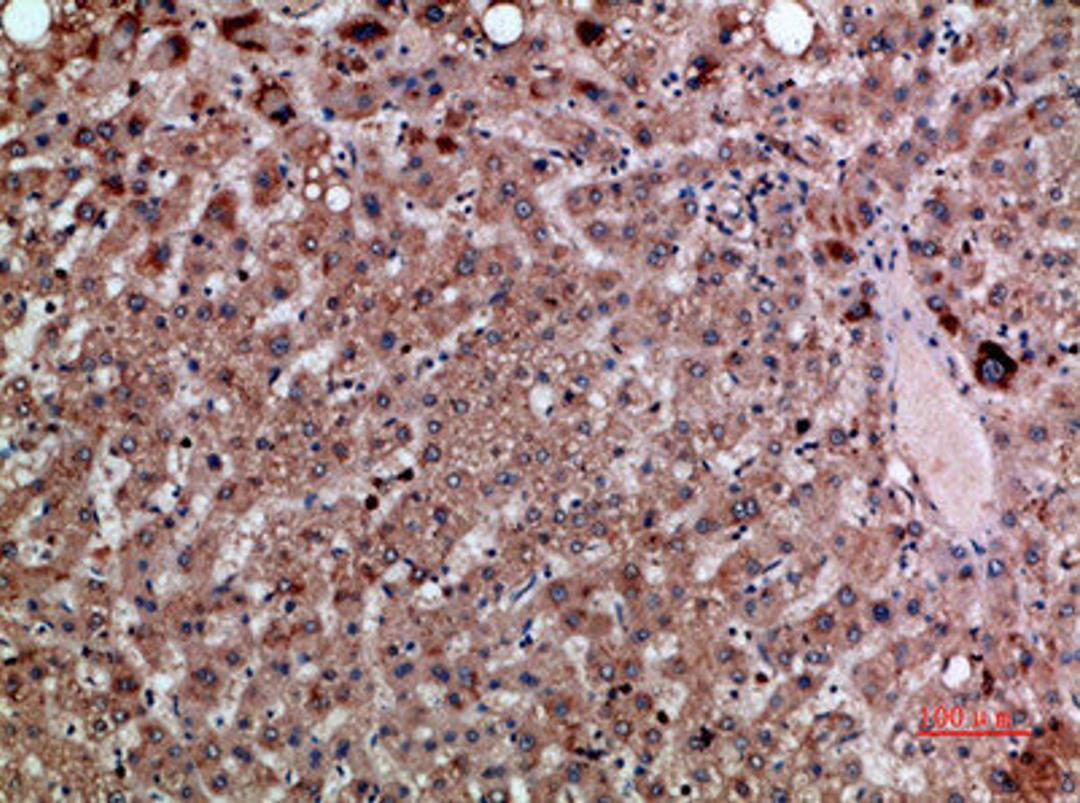 Immunohistochemical analysis of paraffin-embedded human-liver, antibody was diluted at 1:200