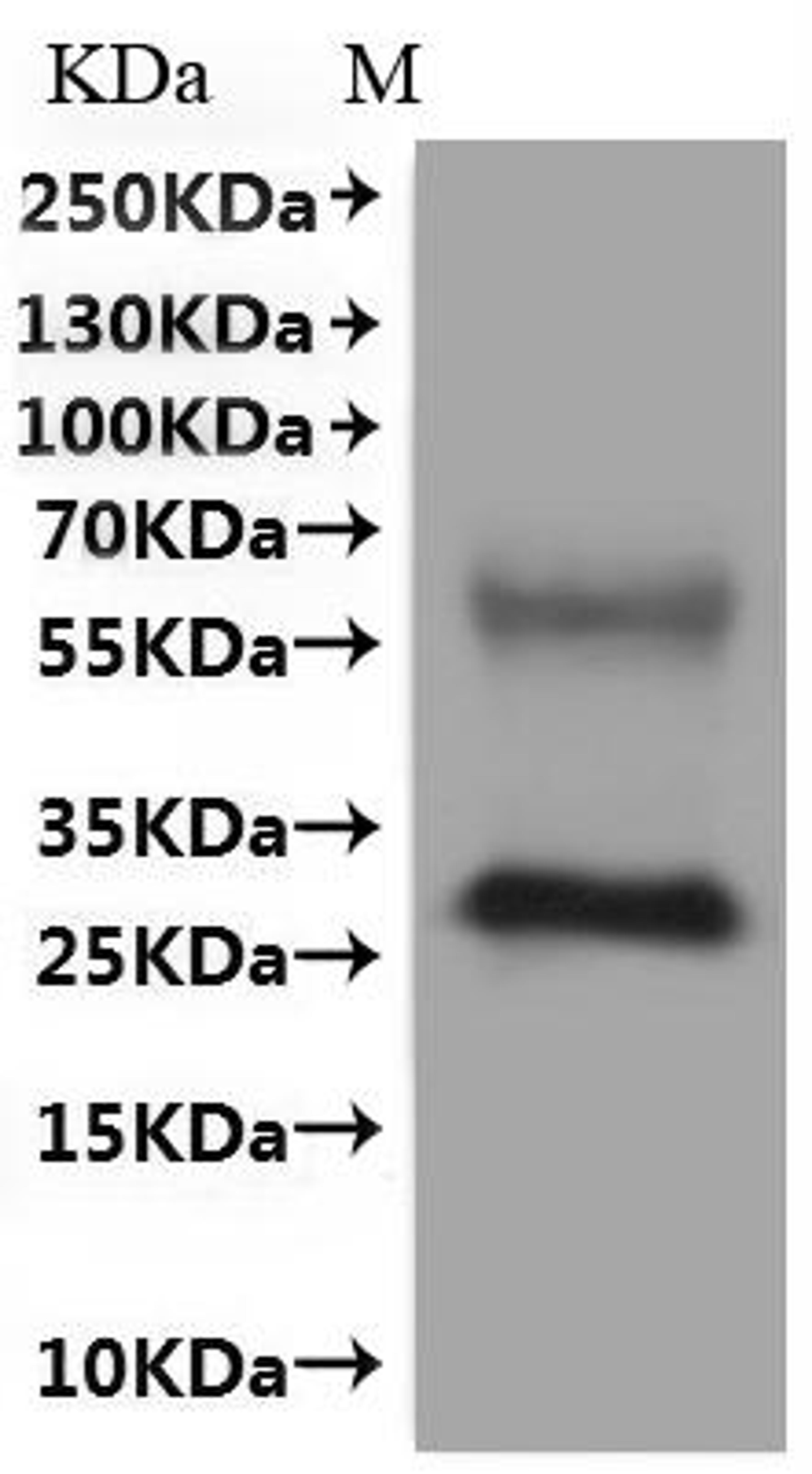 CSB-MP861998HU is detected by Mouse anti-6*His monoclonal antibody.
