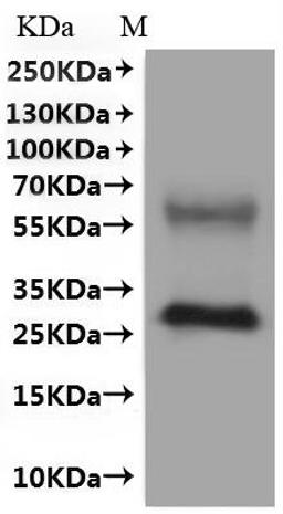 CSB-MP861998HU is detected by Mouse anti-6*His monoclonal antibody.