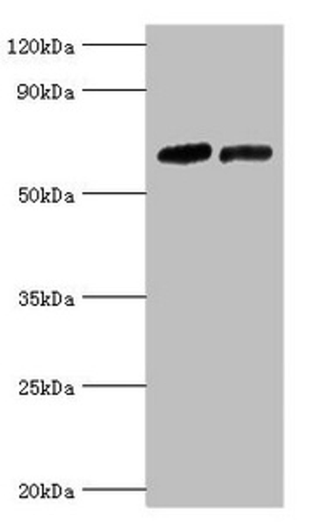 Western blot. All lanes: Nuclear receptor subfamily 2 group C member 1 antibody at 10ug/ml. Lane 1: PC-3 whole cell lysate. Lane 2: 293T whole cell lysate. Secondary. Goat polyclonal to rabbit IgG at 1/10000 dilution. Predicted band size: 68, 52, 54 kDa. Observed band size: 68 kDa. 