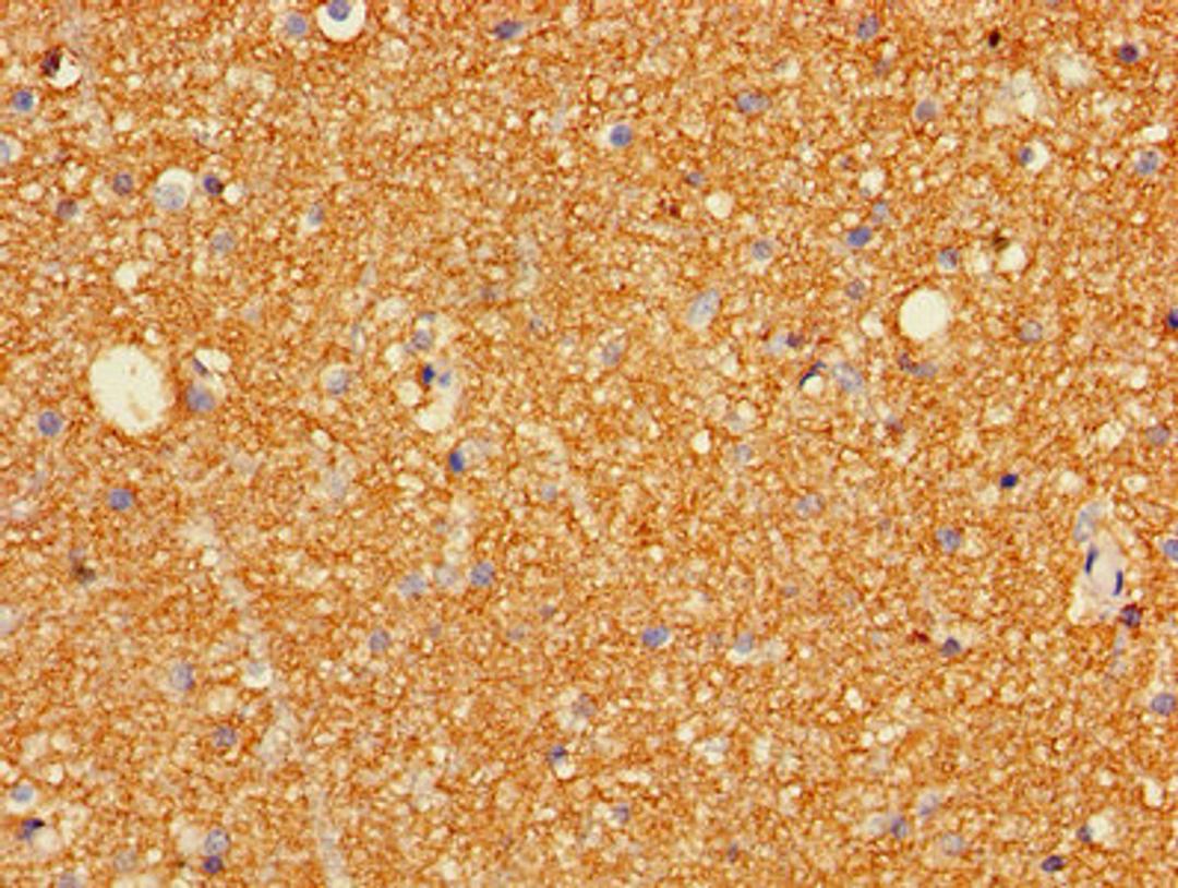 Immunohistochemistry of paraffin-embedded human brain tissue using CSB-PA009900LA01HU at dilution of 1:100