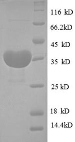 (Tris-Glycine gel) Discontinuous SDS-PAGE (reduced) with 5% enrichment gel and 15% separation gel.