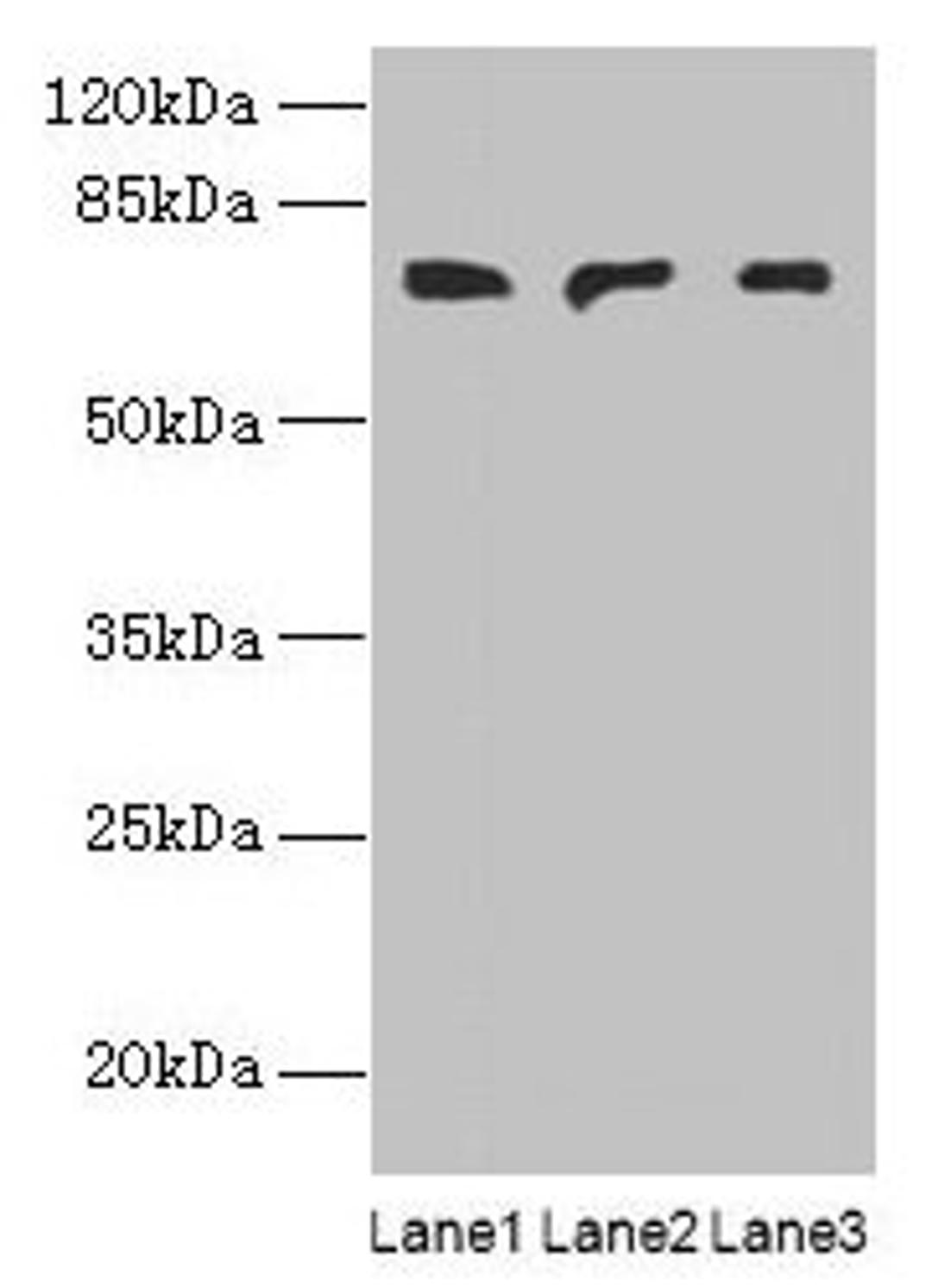 Western blot. All lanes: PLCZ1 antibody at 3µg/ml. Lane 1: Mouse liver tissue. Lane 2: Mouse kidney tissue. Lane 3: Human placenta tissue. Secondary. Goat polyclonal to rabbit IgG at 1/10000 dilution. Predicted band size: 71, 48, 58 kDa. Observed band size: 71 kDa