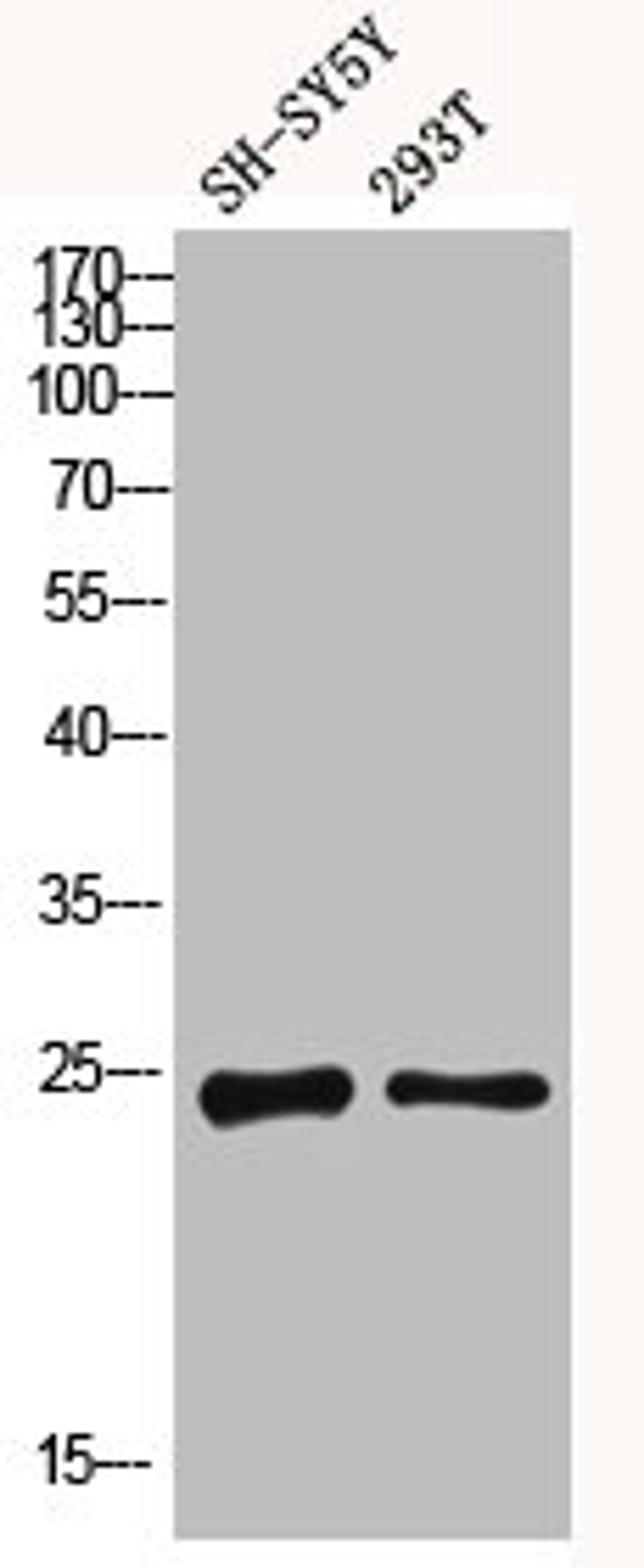 Western blot analysis of SH-SY5Y 293T using Dectin-2 antibody. Antibody was diluted at 1:1000. Secondary antibody  was diluted at 1:20000