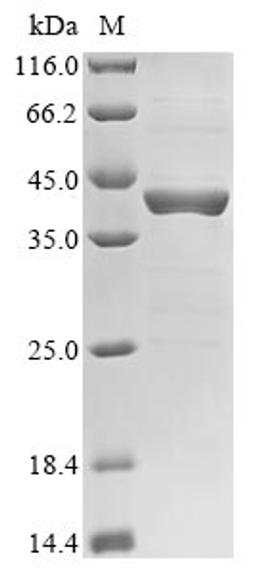(Tris-Glycine gel) Discontinuous SDS-PAGE (reduced) with 5% enrichment gel and 15% separation gel.