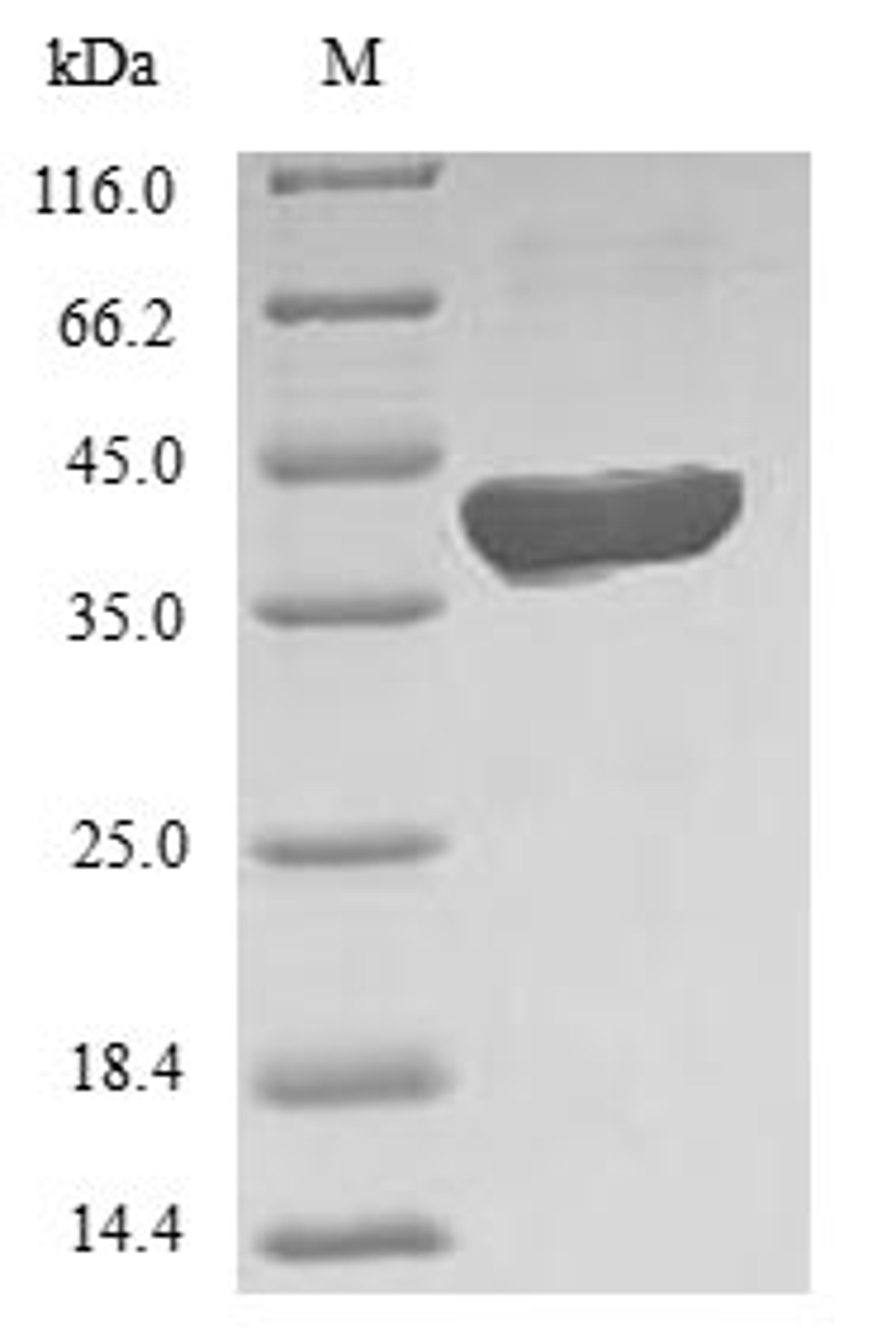 (Tris-Glycine gel) Discontinuous SDS-PAGE (reduced) with 5% enrichment gel and 15% separation gel.