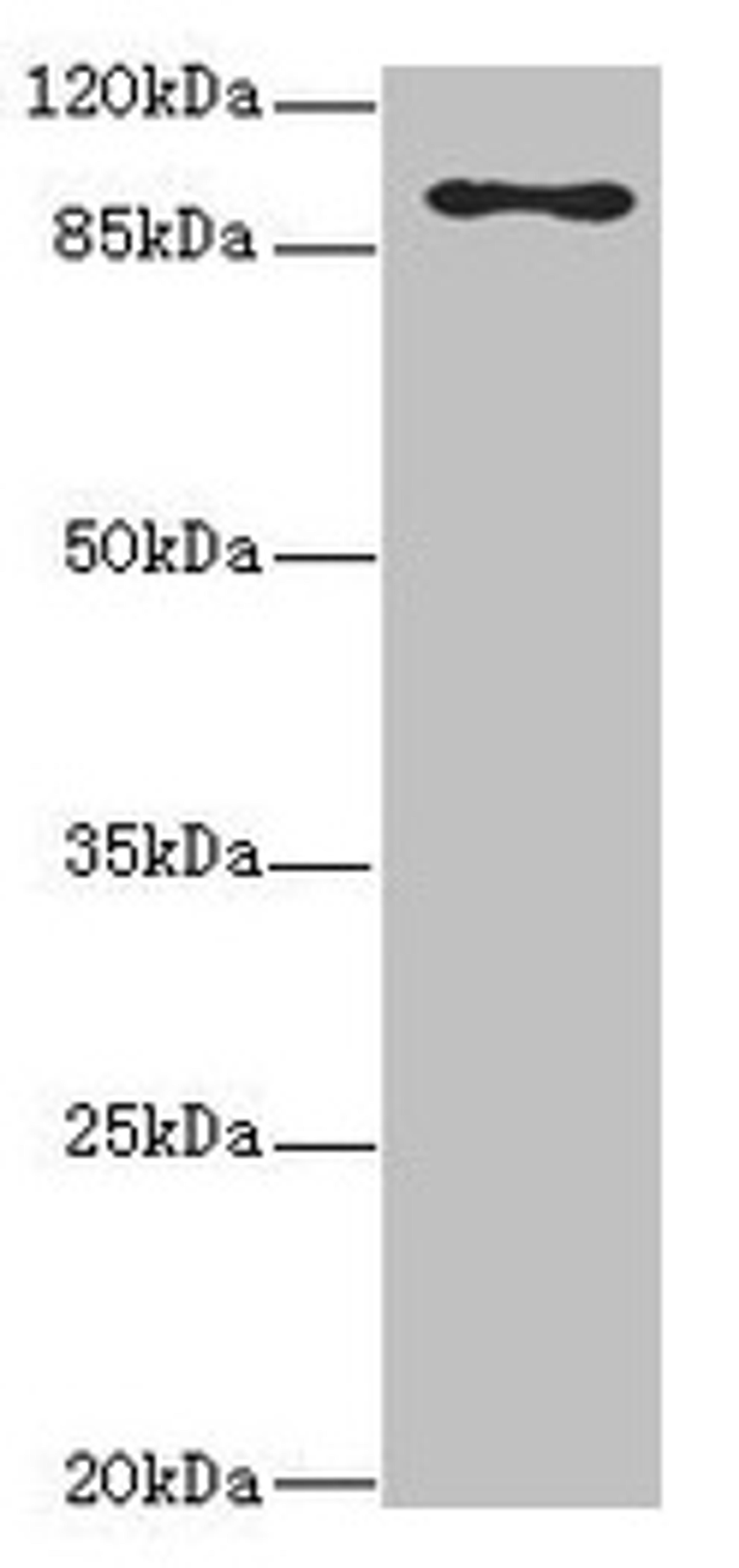 Western blot. All lanes: MTHFD1L antibody at 3.68µg/ml + Hela whole cell lysate. Secondary. Goat polyclonal to rabbit IgG at 1/10000 dilution. Predicted band size: 106, 30 kDa. Observed band size: 106 kDa