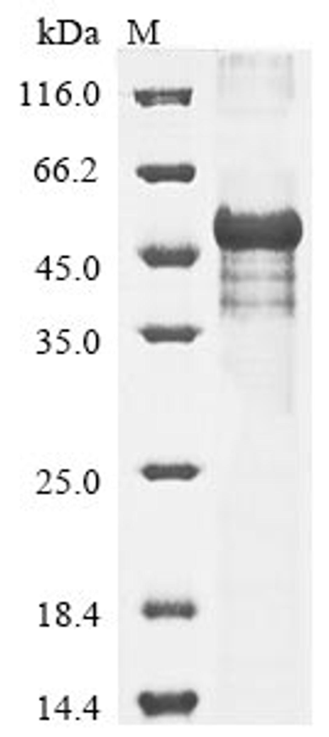 (Tris-Glycine gel) Discontinuous SDS-PAGE (reduced) with 5% enrichment gel and 15% separation gel.