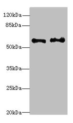Western blot. All lanes: NMT2 antibody at 4.99ug/ml. Lane 1: Human placenta tissue. Lane 2: K562 whole cell lysate. Secondary. Goat polyclonal to rabbit IgG at 1/10000 dilution. Predicted band size: 57 kDa. Observed band size: 57 kDa. 