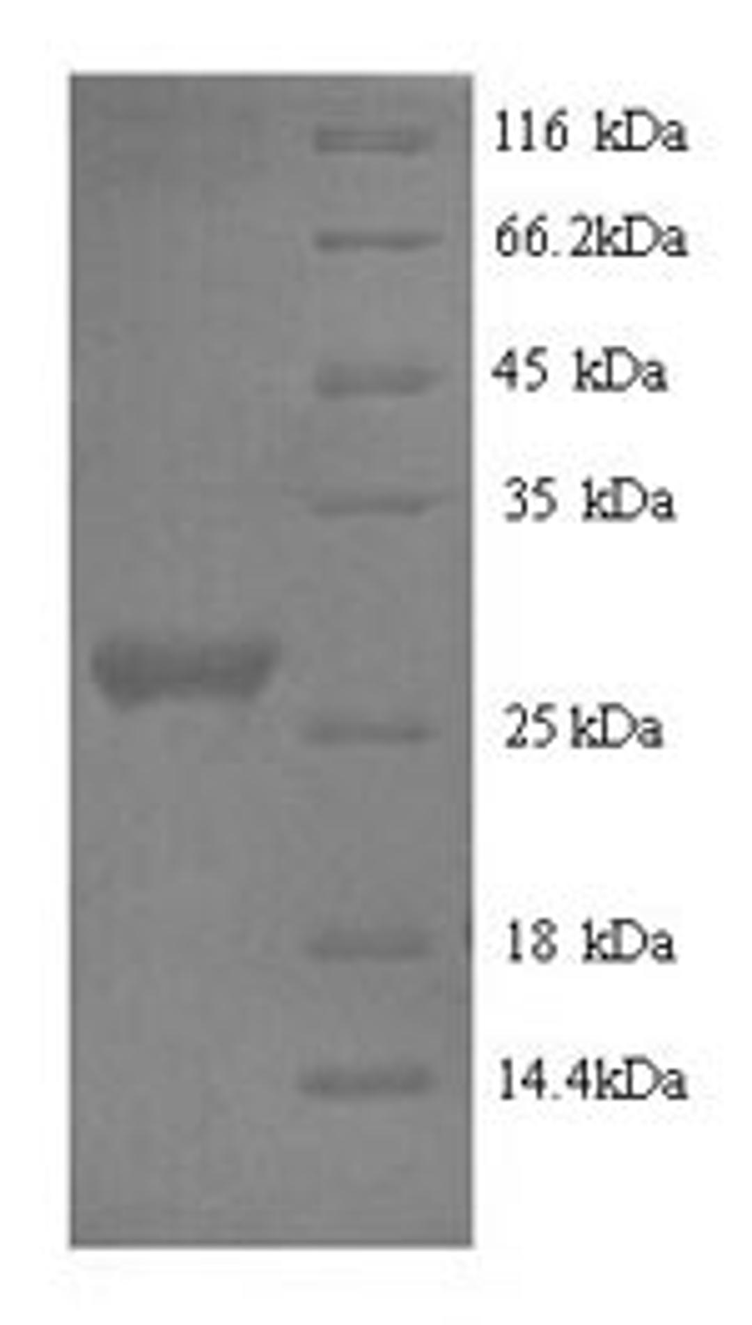 (Tris-Glycine gel) Discontinuous SDS-PAGE (reduced) with 5% enrichment gel and 15% separation gel.