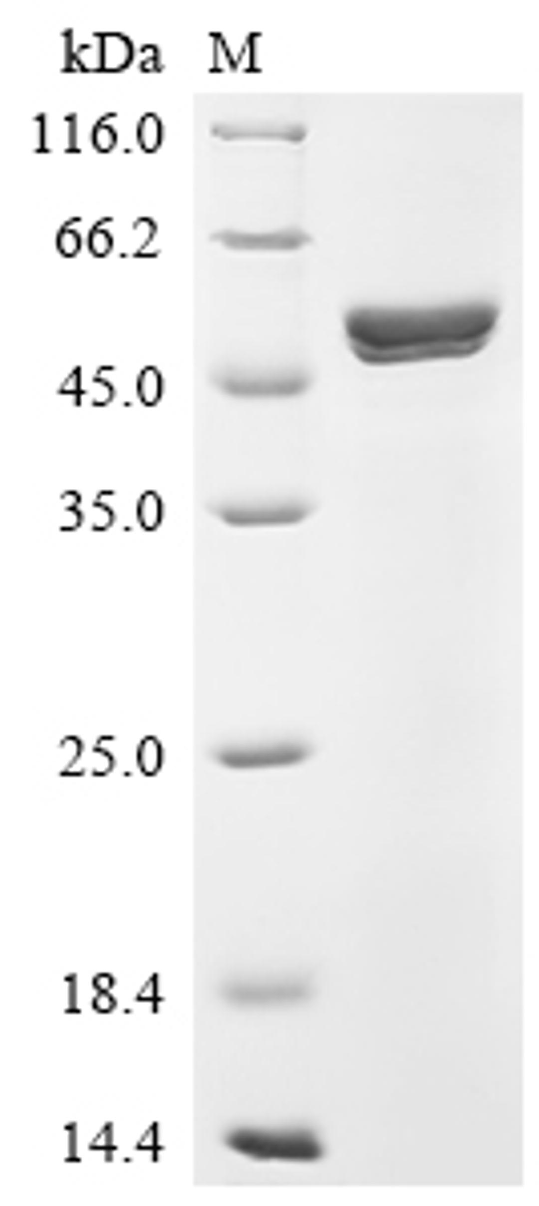 (Tris-Glycine gel) Discontinuous SDS-PAGE (reduced) with 5% enrichment gel and 15% separation gel.