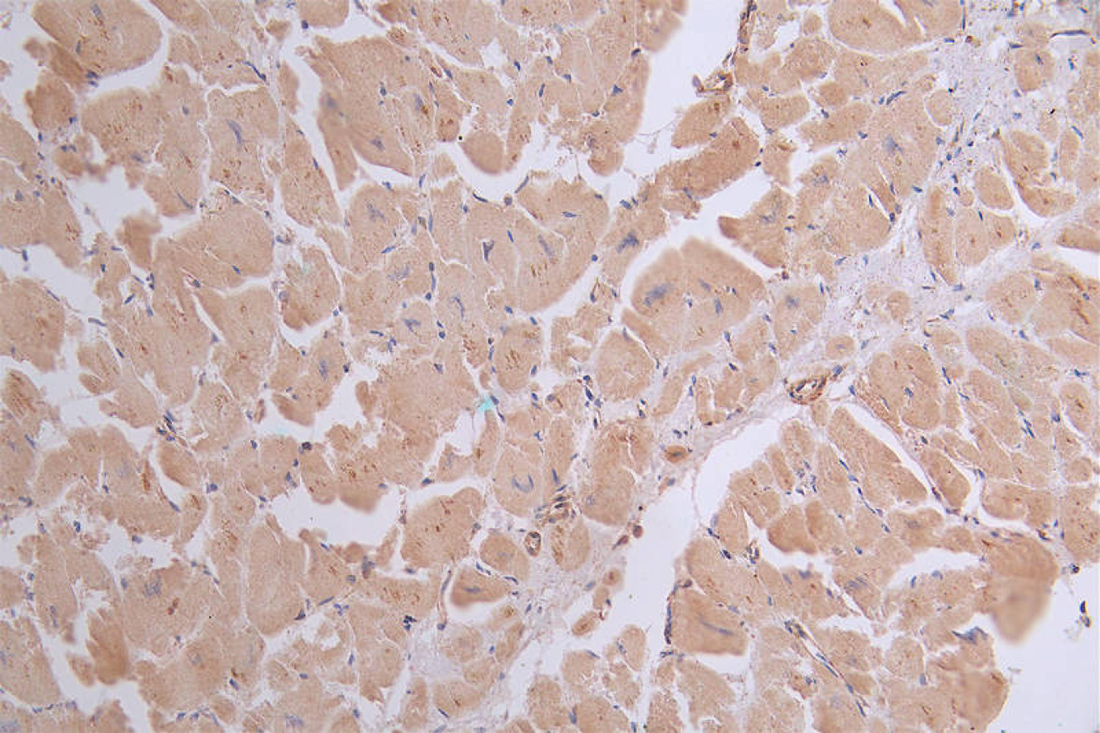 IHC image of CSB-RA076873A0HU diluted at 1:50 and staining in paraffin-embedded human heart tissue performed on a Leica BondTM system. After dewaxing and hydration, antigen retrieval was mediated by high pressure in a citrate buffer (pH 6.0). Section was blocked with 10% normal goat serum 30min at RT. Then primary antibody (1% BSA) was incubated at 4°C overnight. The primary is detected by a Goat anti-rabbit polymer IgG labeled by HRP and visualized using 0.41% DAB.
