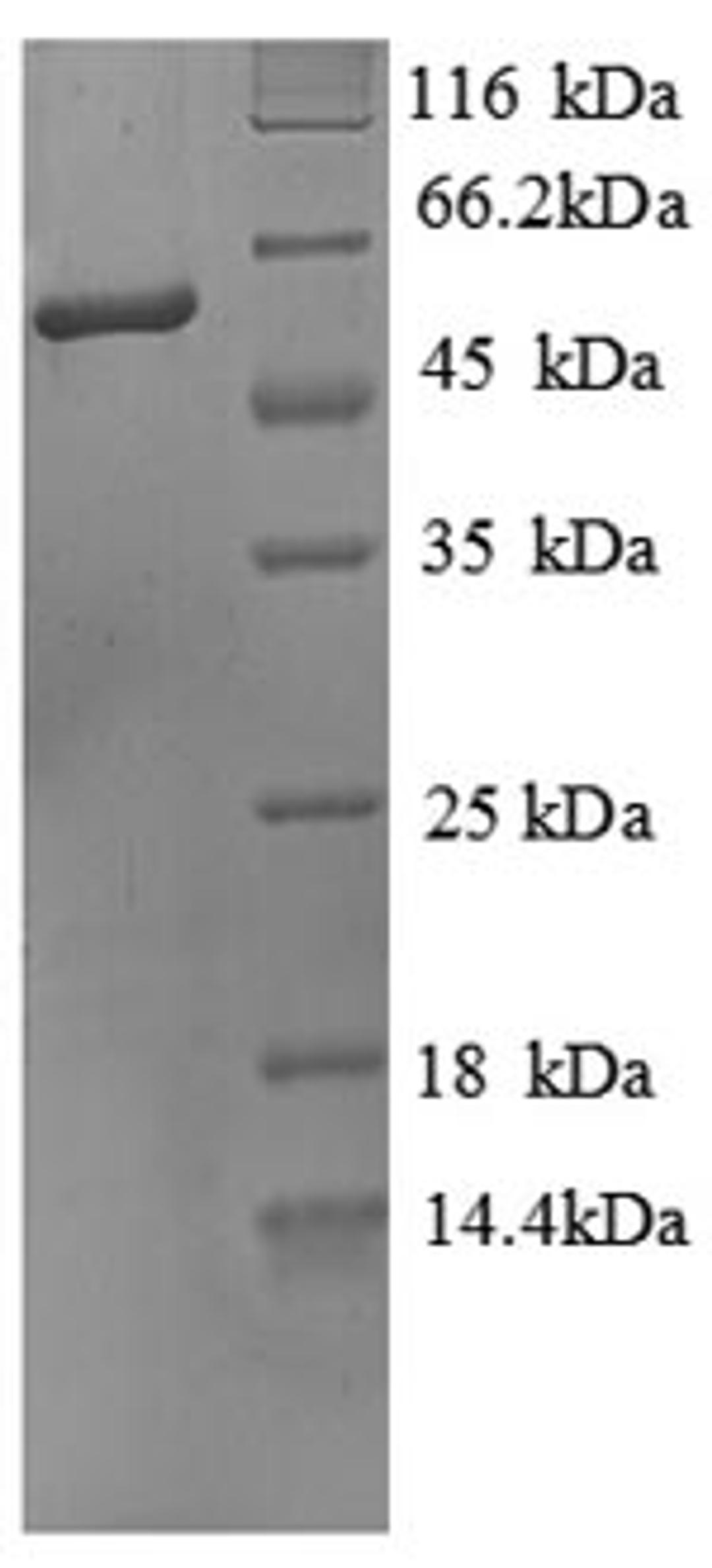 (Tris-Glycine gel) Discontinuous SDS-PAGE (reduced) with 5% enrichment gel and 15% separation gel.