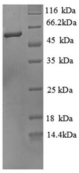 (Tris-Glycine gel) Discontinuous SDS-PAGE (reduced) with 5% enrichment gel and 15% separation gel.