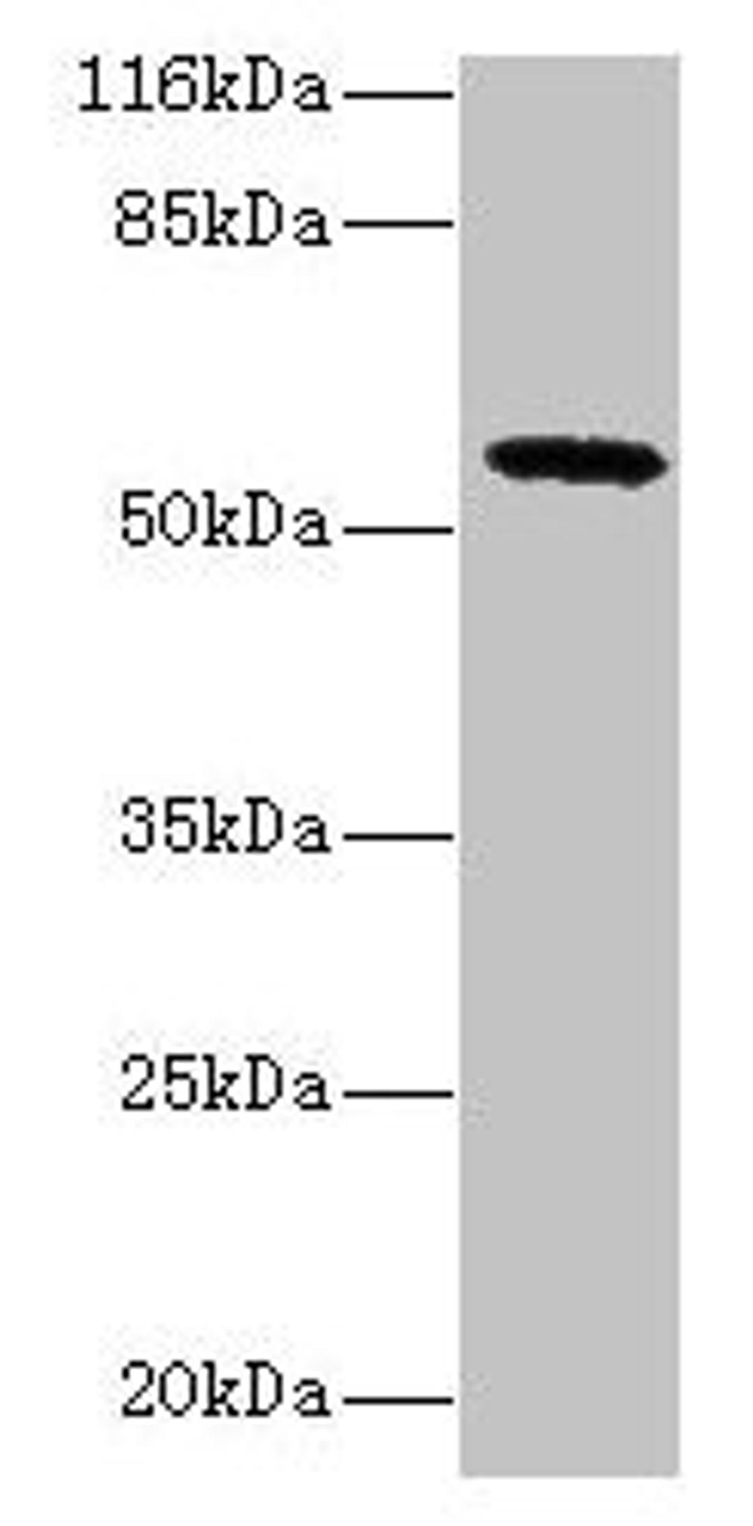 Western blot. All lanes: GDAP2 antibody at 2µg/ml + MCF-7 whole cell lysate. Secondary. Goat polyclonal to rabbit IgG at 1/10000 dilution. Predicted band size: 57 kDa. Observed band size: 57 kDa