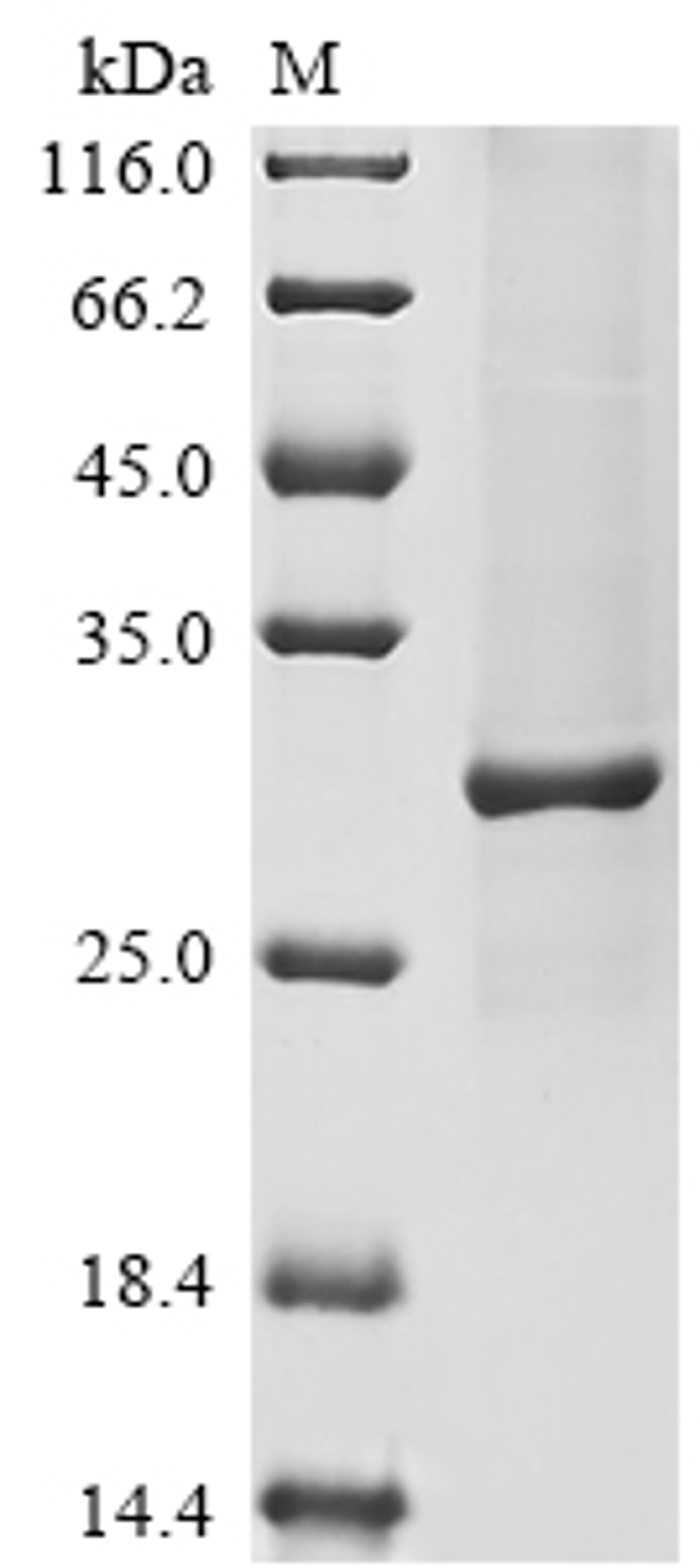 (Tris-Glycine gel) Discontinuous SDS-PAGE (reduced) with 5% enrichment gel and 15% separation gel.