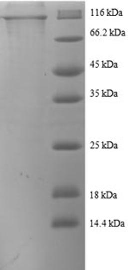 (Tris-Glycine gel) Discontinuous SDS-PAGE (reduced) with 5% enrichment gel and 15% separation gel.